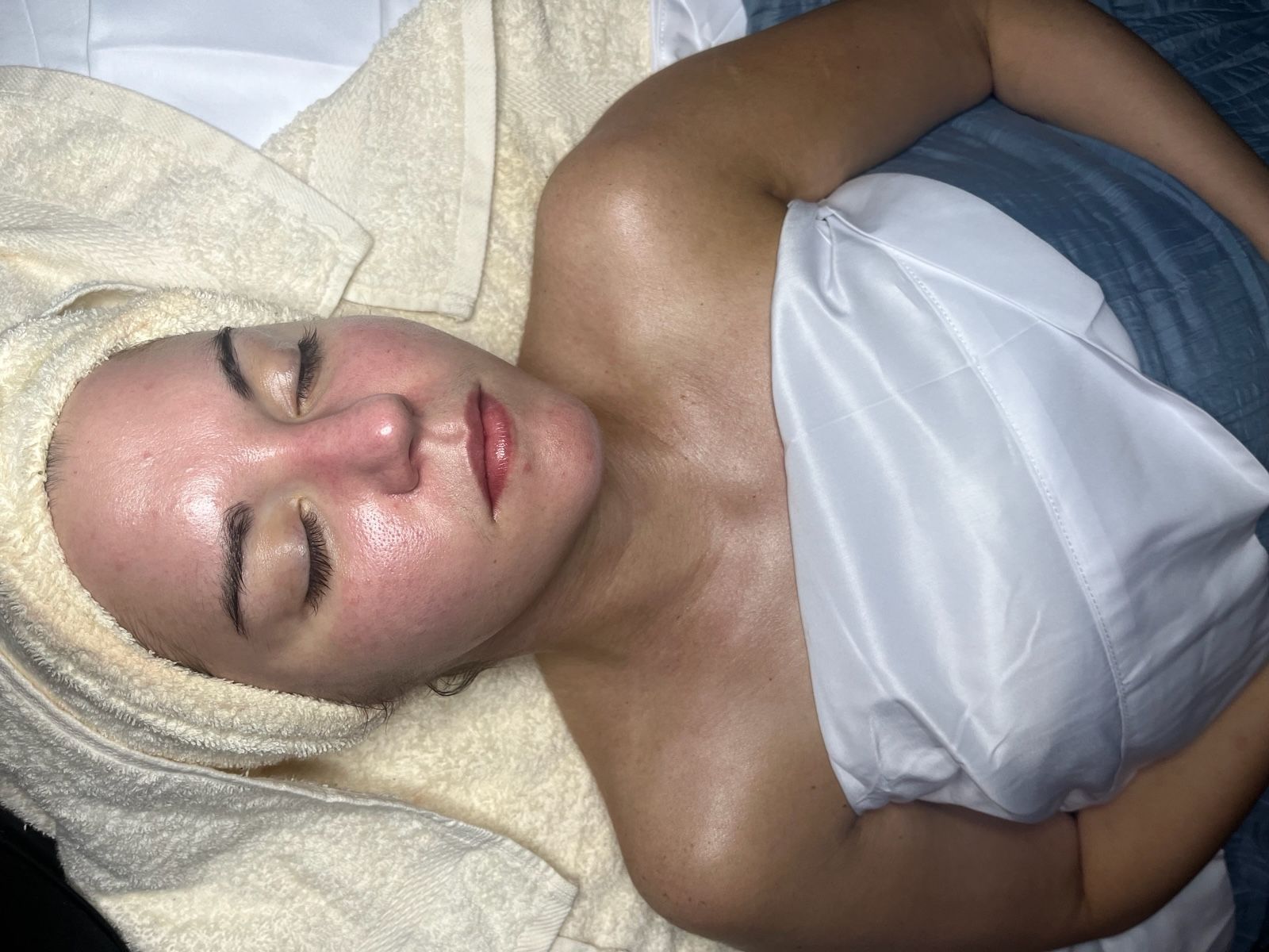 Close-up of a woman lying on a towel with eyes closed, face turned up for a acne healing facial at Spa La La Tampa