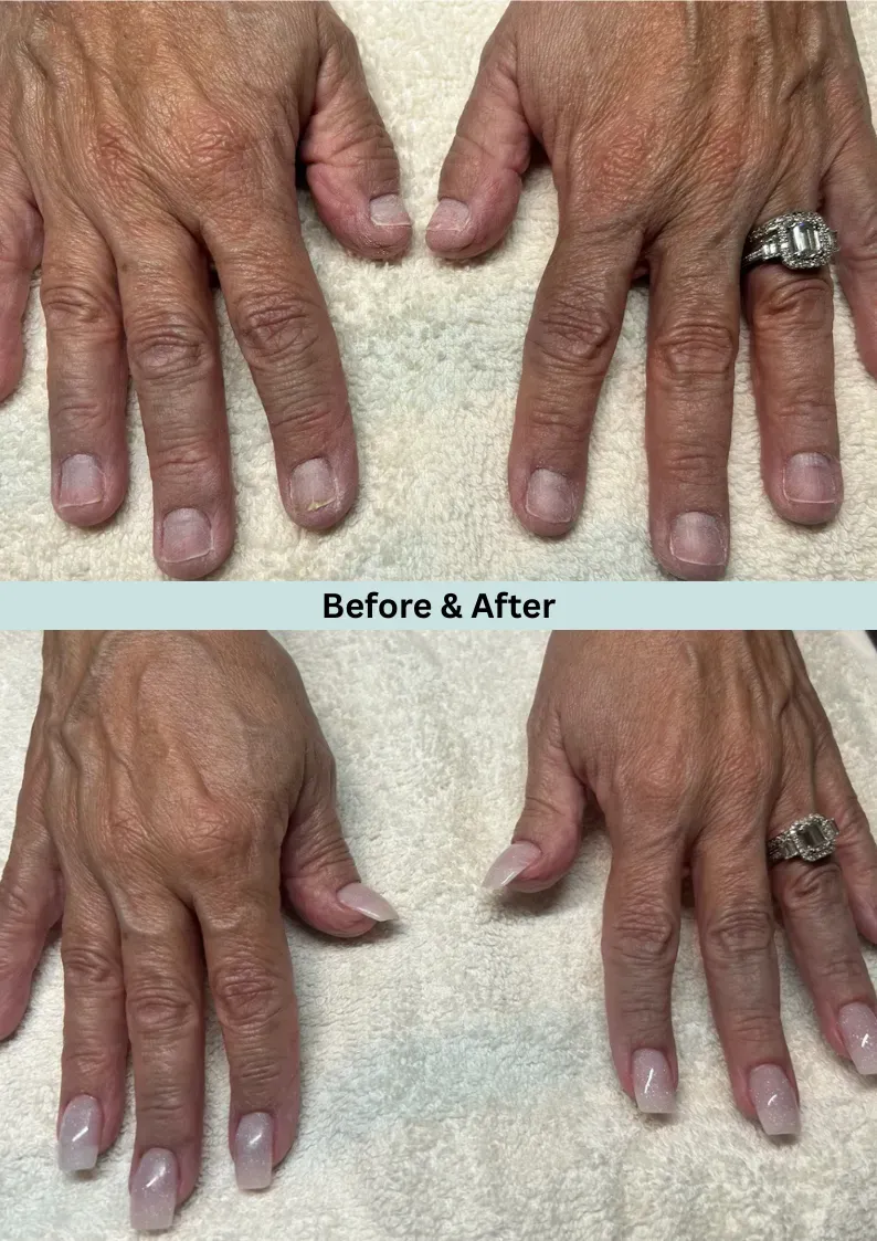 Before & after view of hands with bare nails, then with manicured nails. Before & after view of hands with bare nails, then with manicured nails.