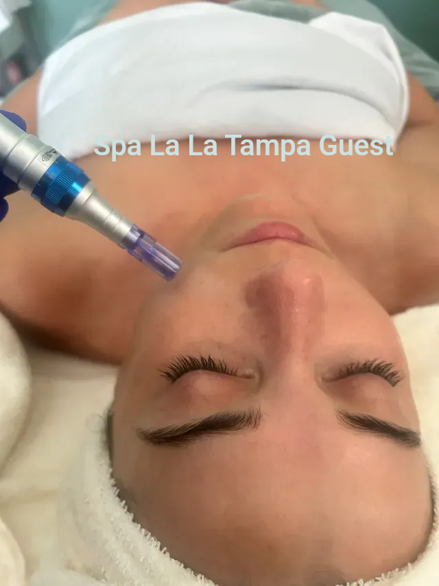 Microneedling treatment being applied to skin to stimulate collagen and improve texture at Spa La La Tampa Microneedling treatment being applied to skin to stimulate collagen and improve texture at Spa La La Tampa