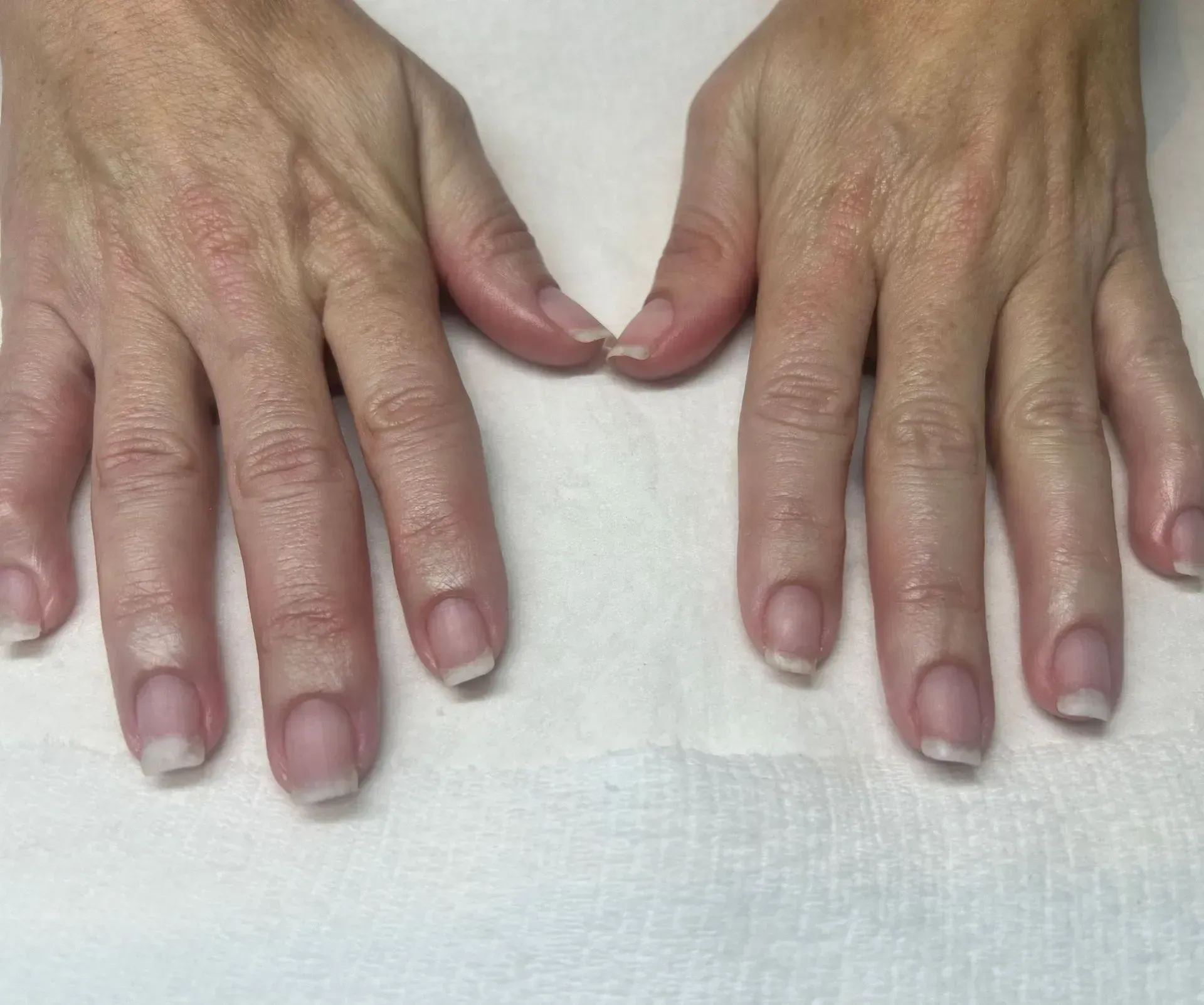 Two hands with unpainted, natural nails.
