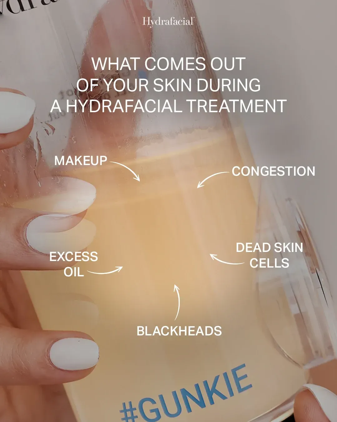 Hydrafacial promo graphic showing makeup, excess oil, blackheads, congestion, and dead skin cells on skin.
