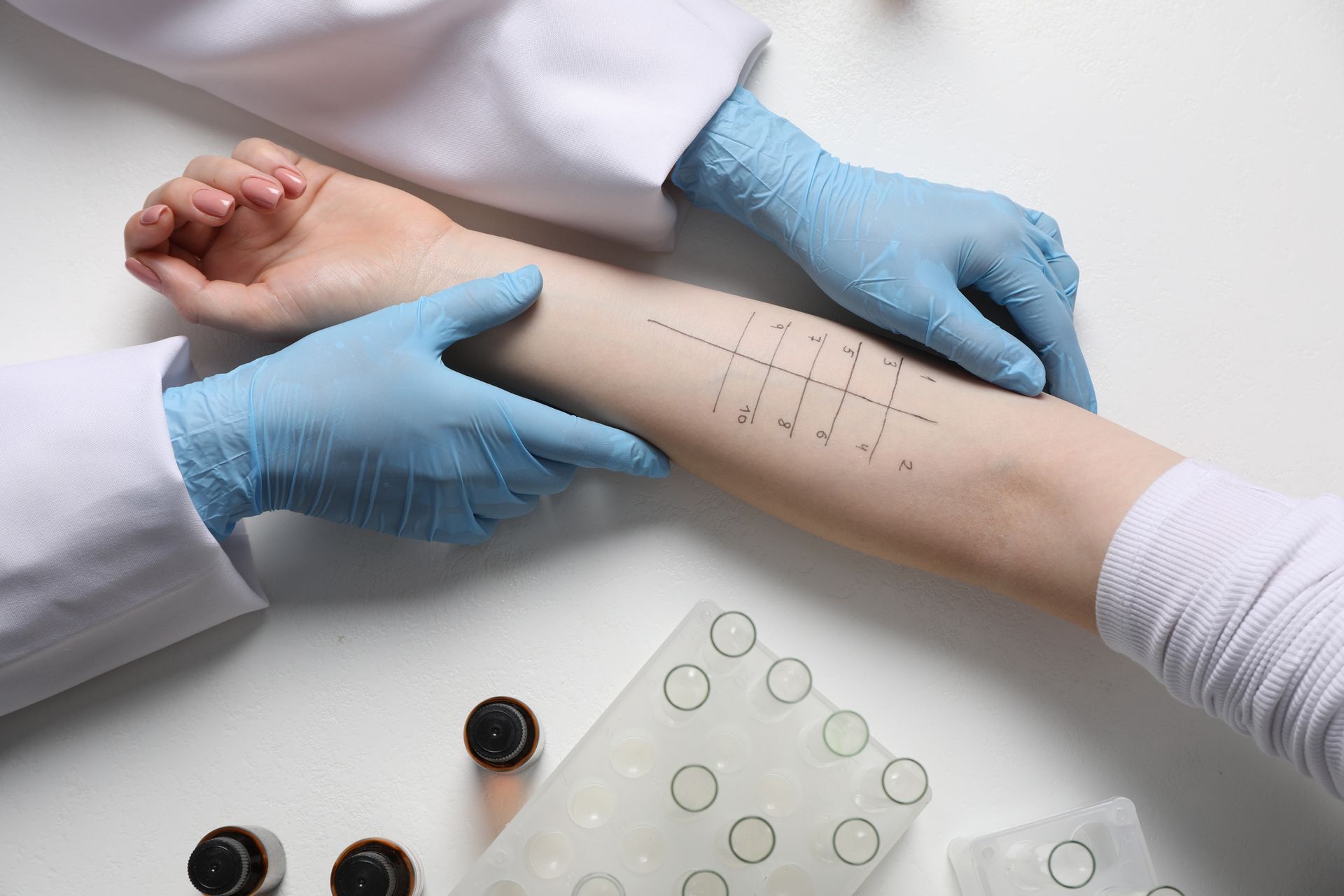 Doctor doing skin allergy test at light table