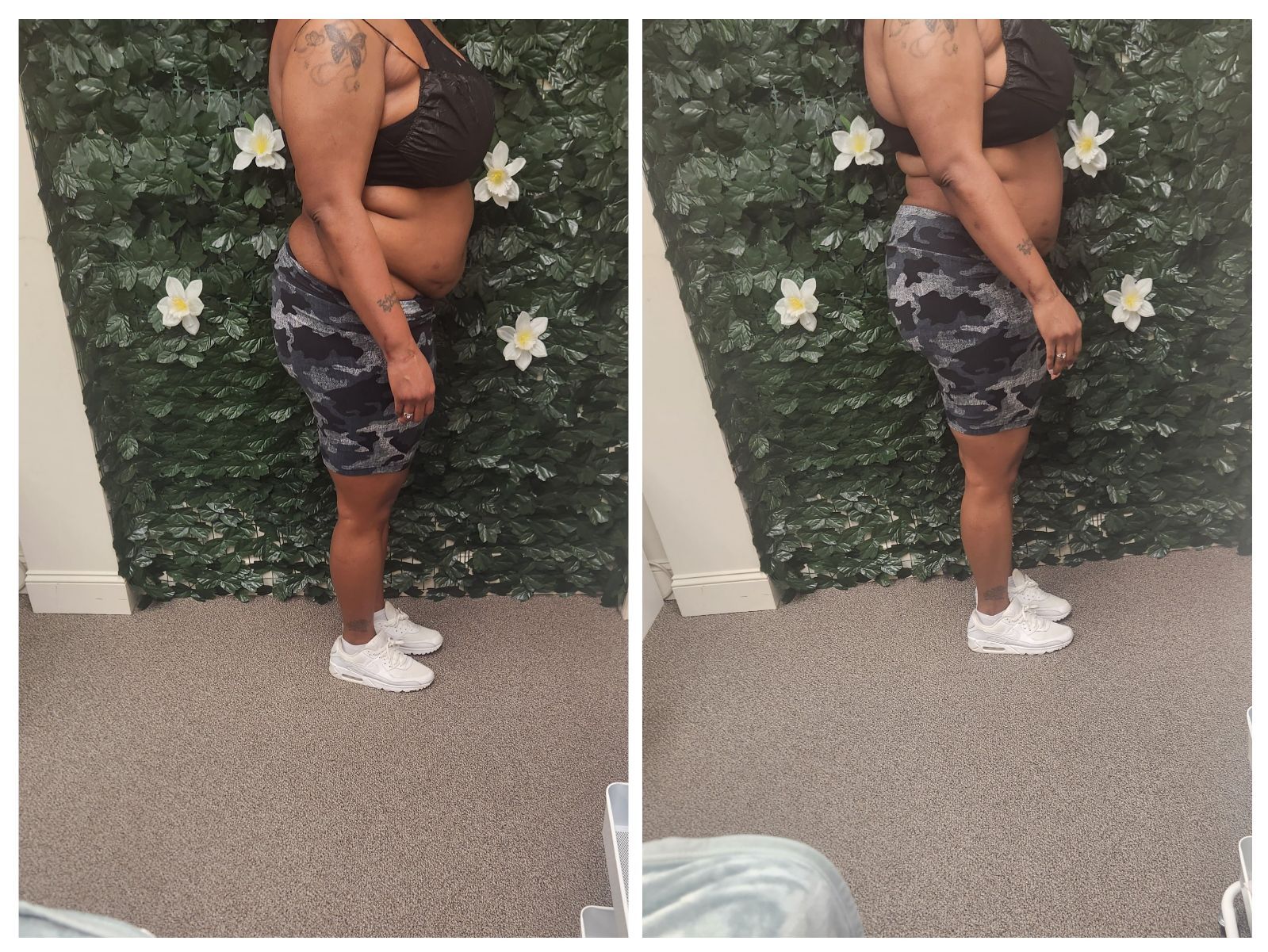 Before-and-after photos of a woman; she wears a black top and patterned shorts, 
