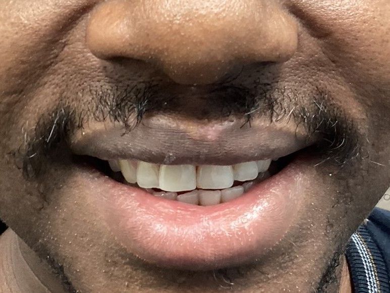 A close up of a man 's mouth with a beard and white teeth.