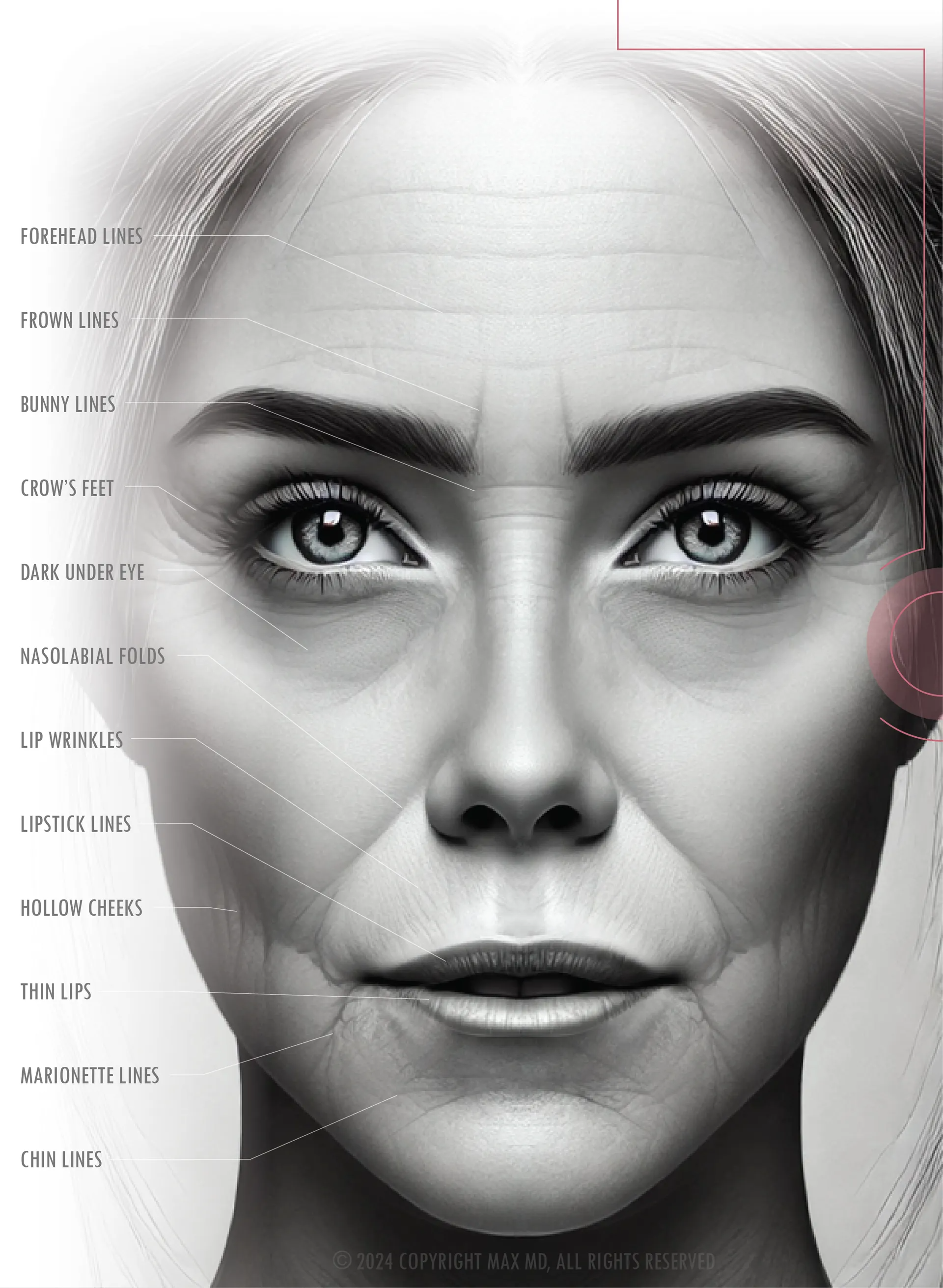 Common aesthetic imperfections