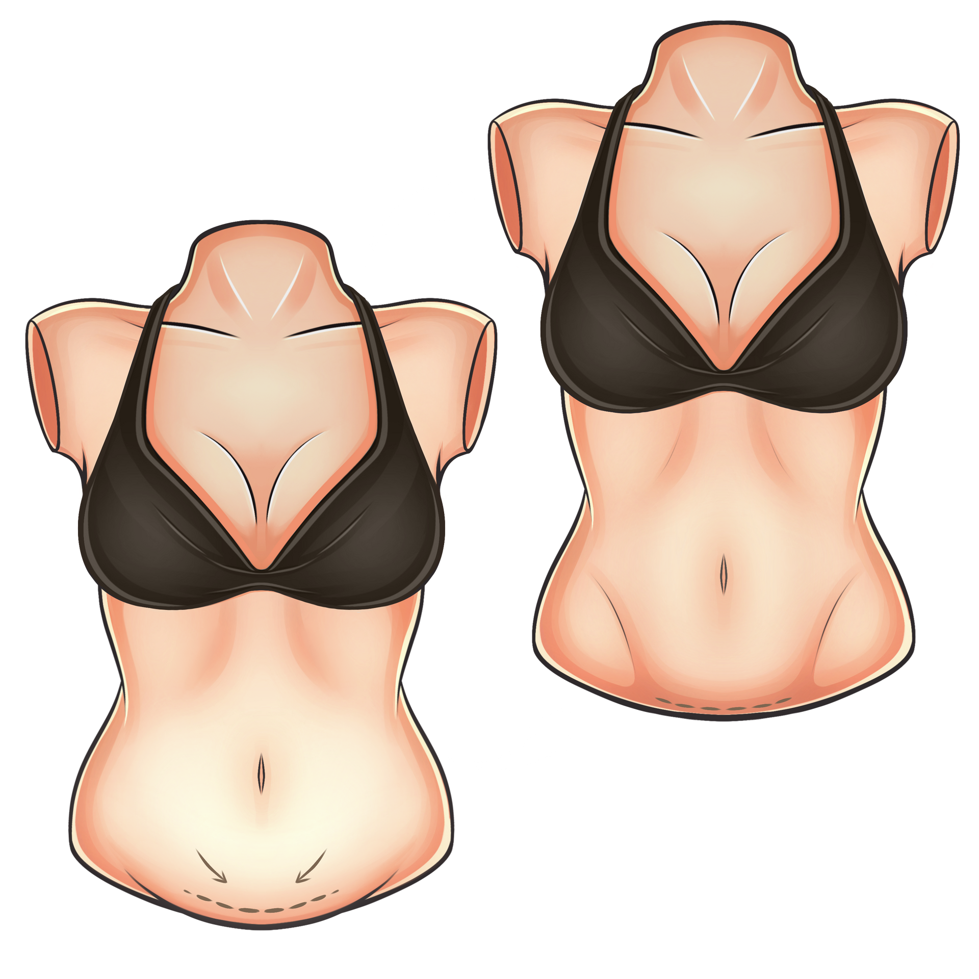 Um desenho do torso de uma mulher com setas apontando para diferentes áreas.
