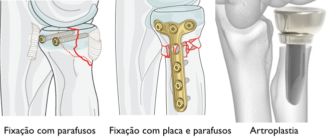 Um desenho de um joelho com uma placa nele.