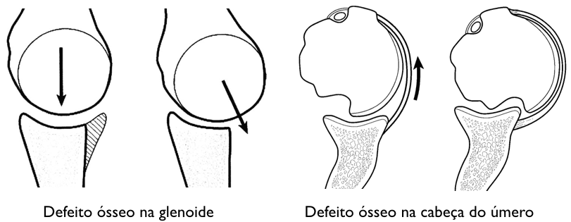 Um desenho em preto e branco de um joelho e uma articulação do ombro.