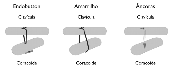 Três tipos diferentes de pontos são mostrados em um fundo branco