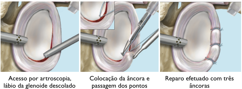 Um desenho animado de uma pessoa sendo operada por um cirurgião