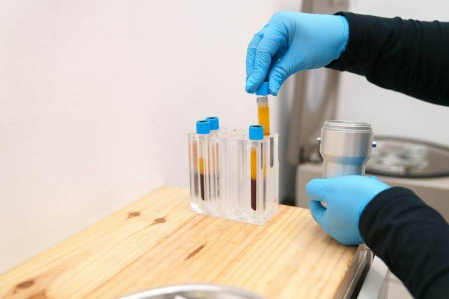 Hands in blue gloves holding and organizing blood sample tubes.