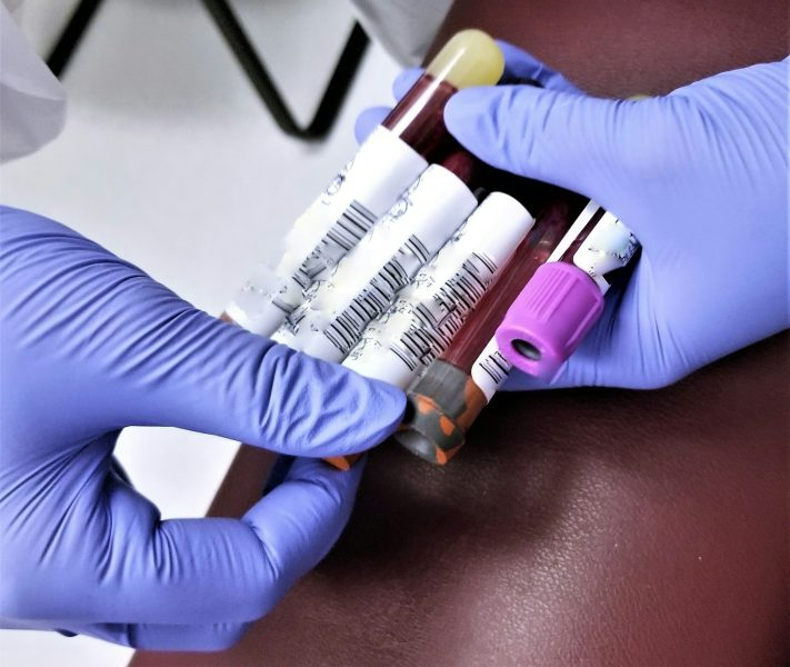 Hands in blue gloves holding multiple blood collection tubes.