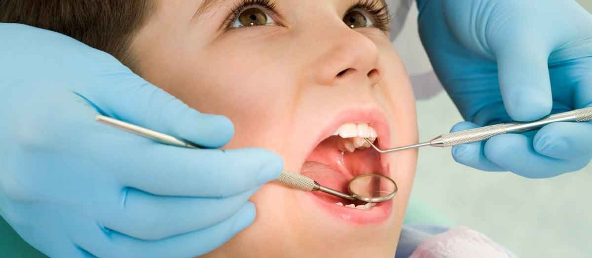cavities in children