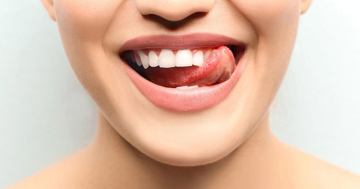 dental implants vs veneers