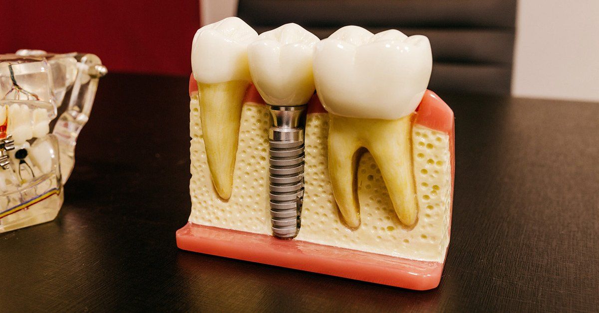 Brewster NY Cosmetic Dentist