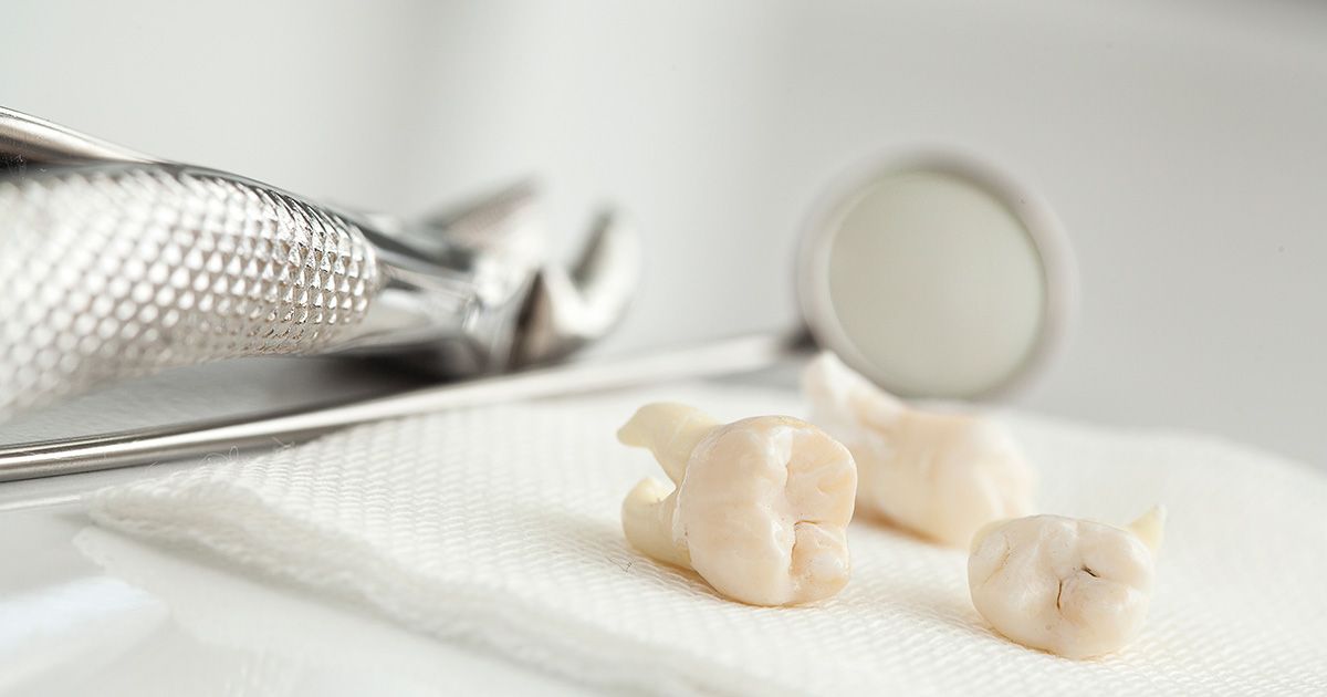 will an ER remove a tooth