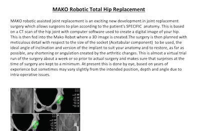 Download - MAKO Robotic Total Hip Replacement