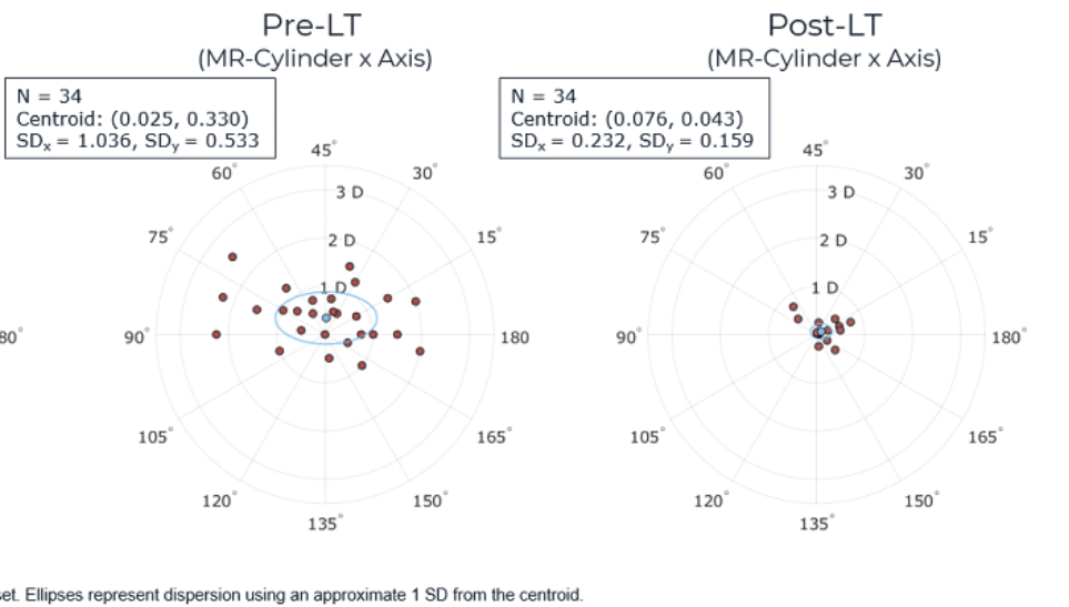 Astigmatism correction by the Light Adjustable Lens