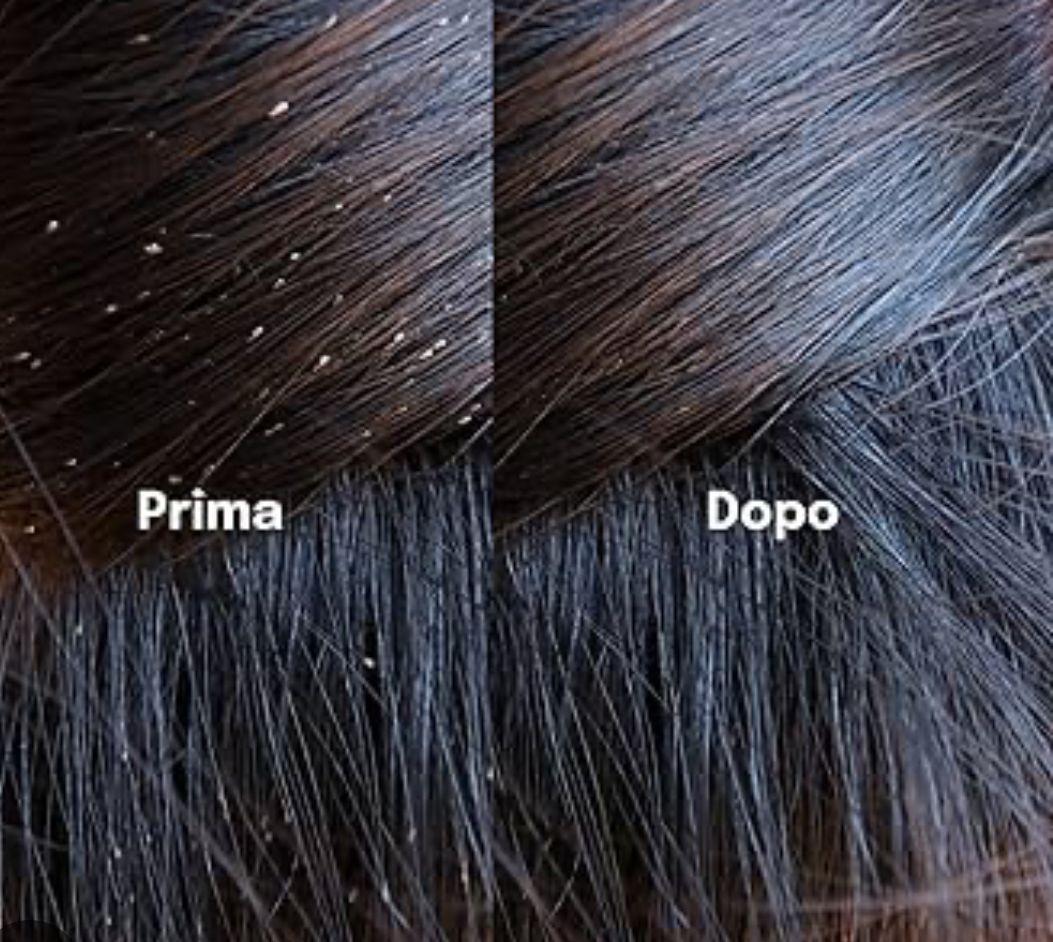 prima e dopo trattamento