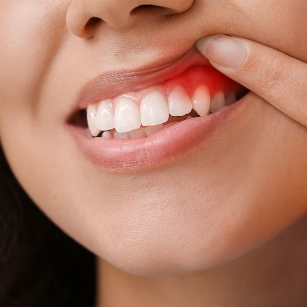 A close up of a woman 's mouth with a red spot on her teeth.