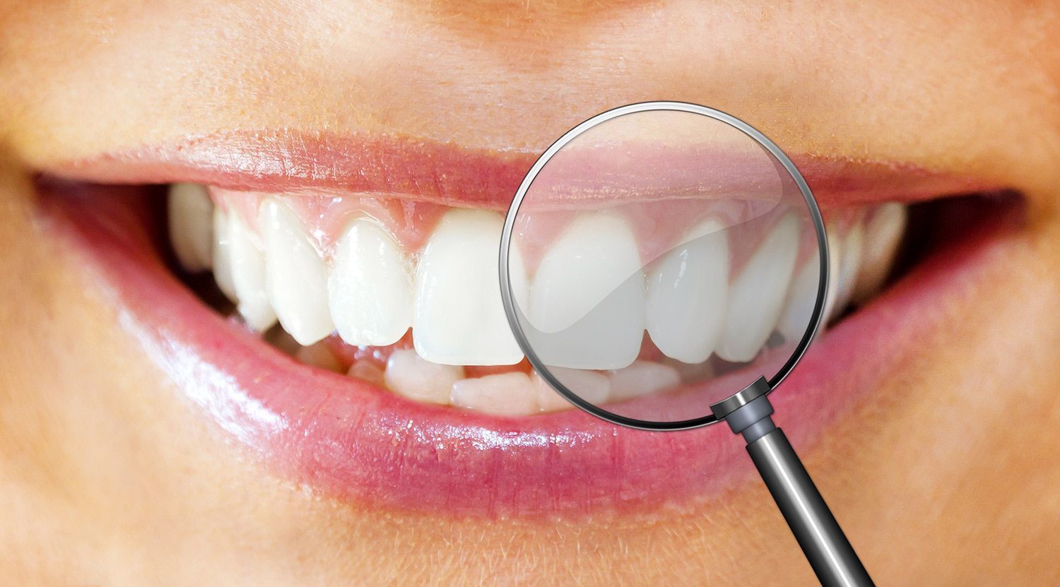Woman's teeth with magnifying glass