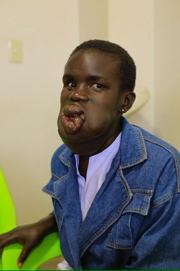 Person in a denim jacket sitting indoors, with a visible facial injury and a serious expression.