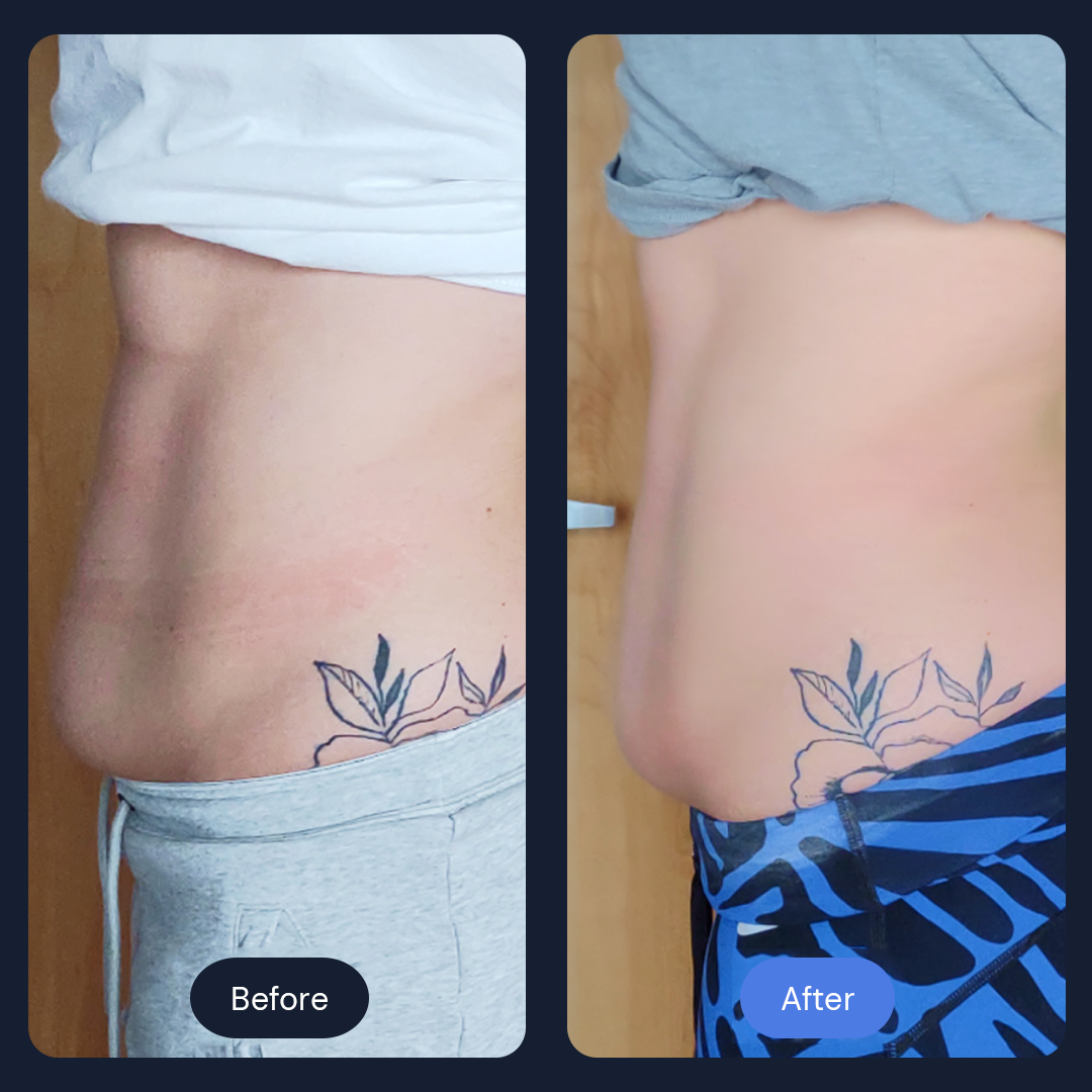 Before & After Gallery | Beauty Bar Wellness & Med Spa | Covington, GA
