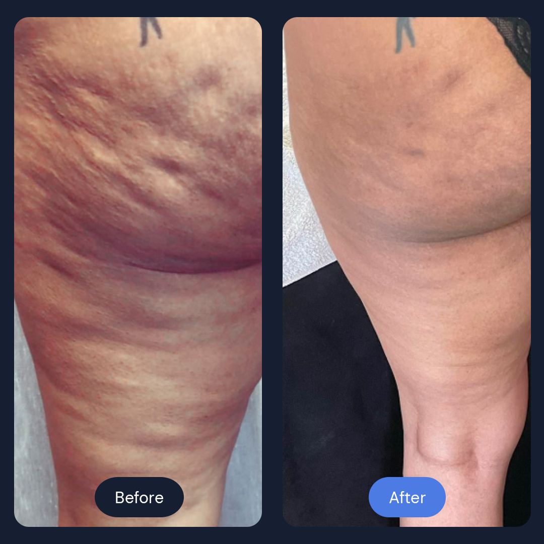Before & After Gallery | Beauty Bar Wellness & Med Spa | Covington, GA
