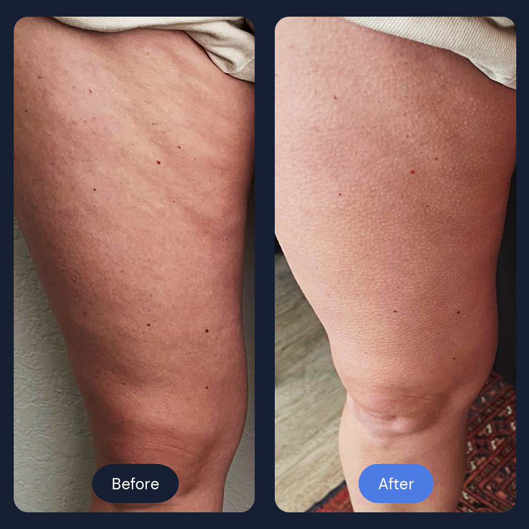 Before & After Gallery | Beauty Bar Wellness & Med Spa | Covington, GA