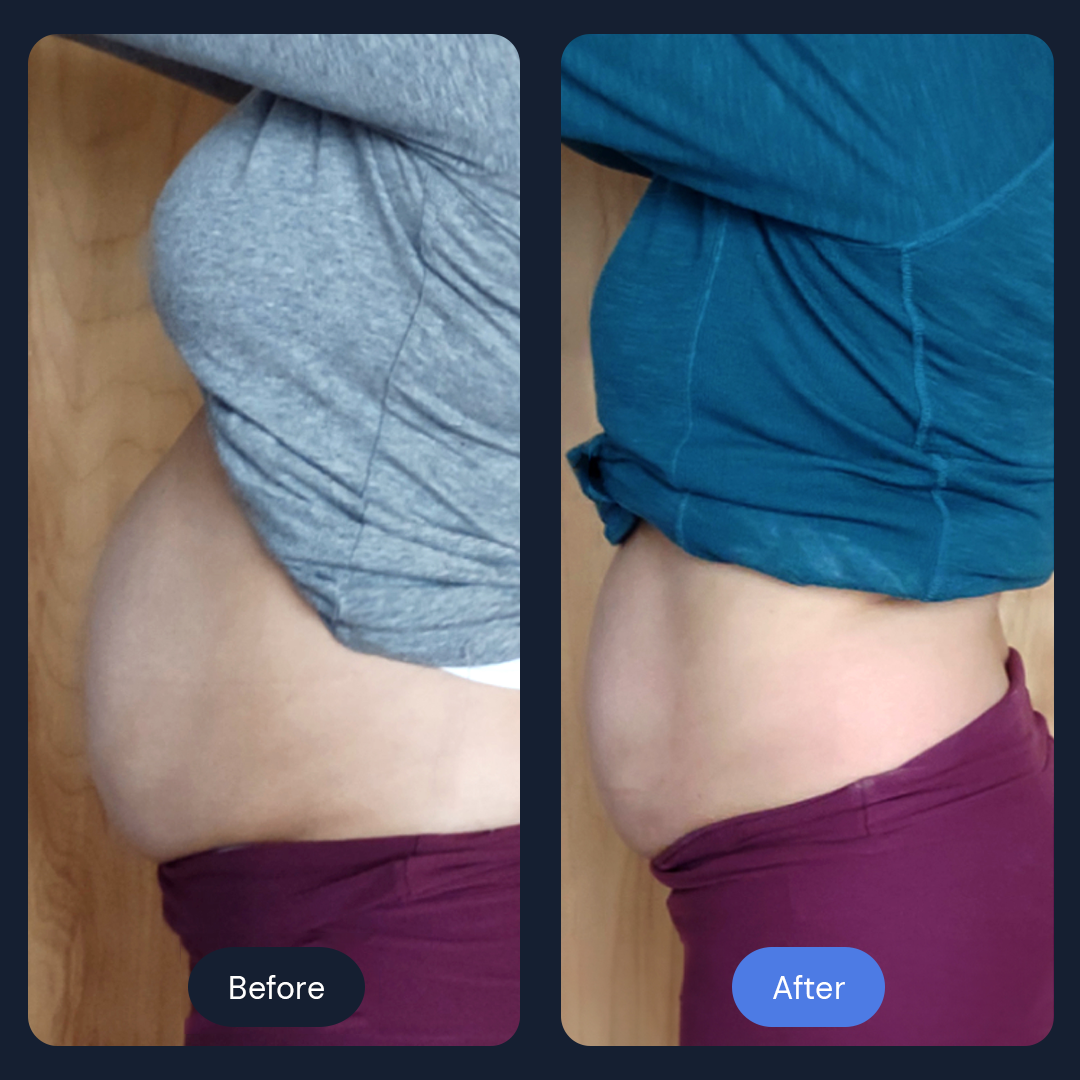 Before & After Gallery | Beauty Bar Wellness & Med Spa | Covington, GA