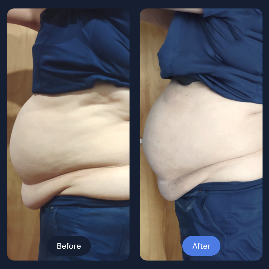 Before & After Gallery | Beauty Bar Wellness & Med Spa | Covington, GA
