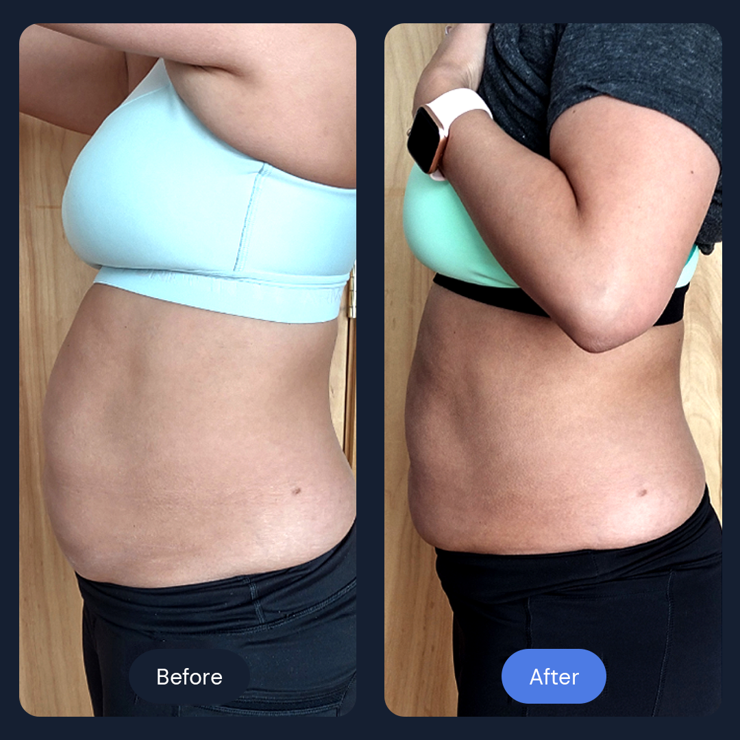 Before & After Gallery | Beauty Bar Wellness & Med Spa | Covington, GA