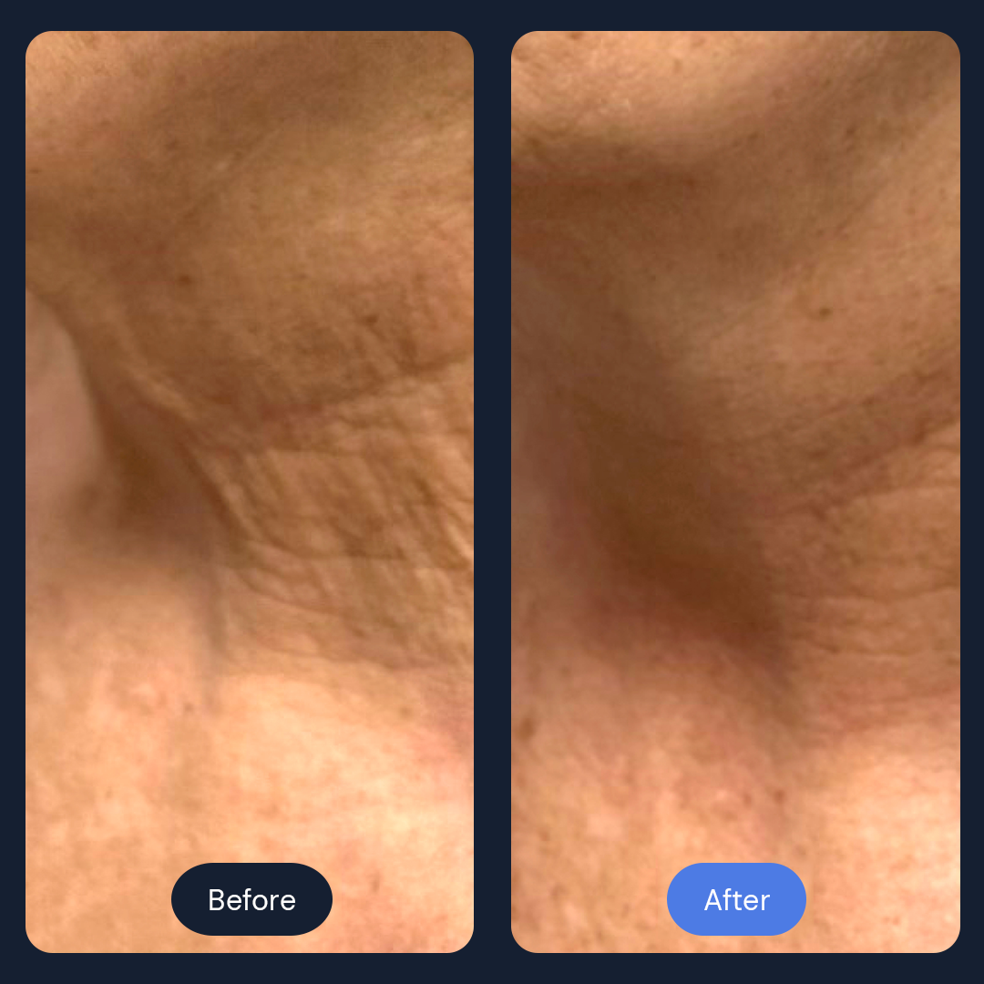 Before & After Gallery | Beauty Bar Wellness & Med Spa | Covington, GA
