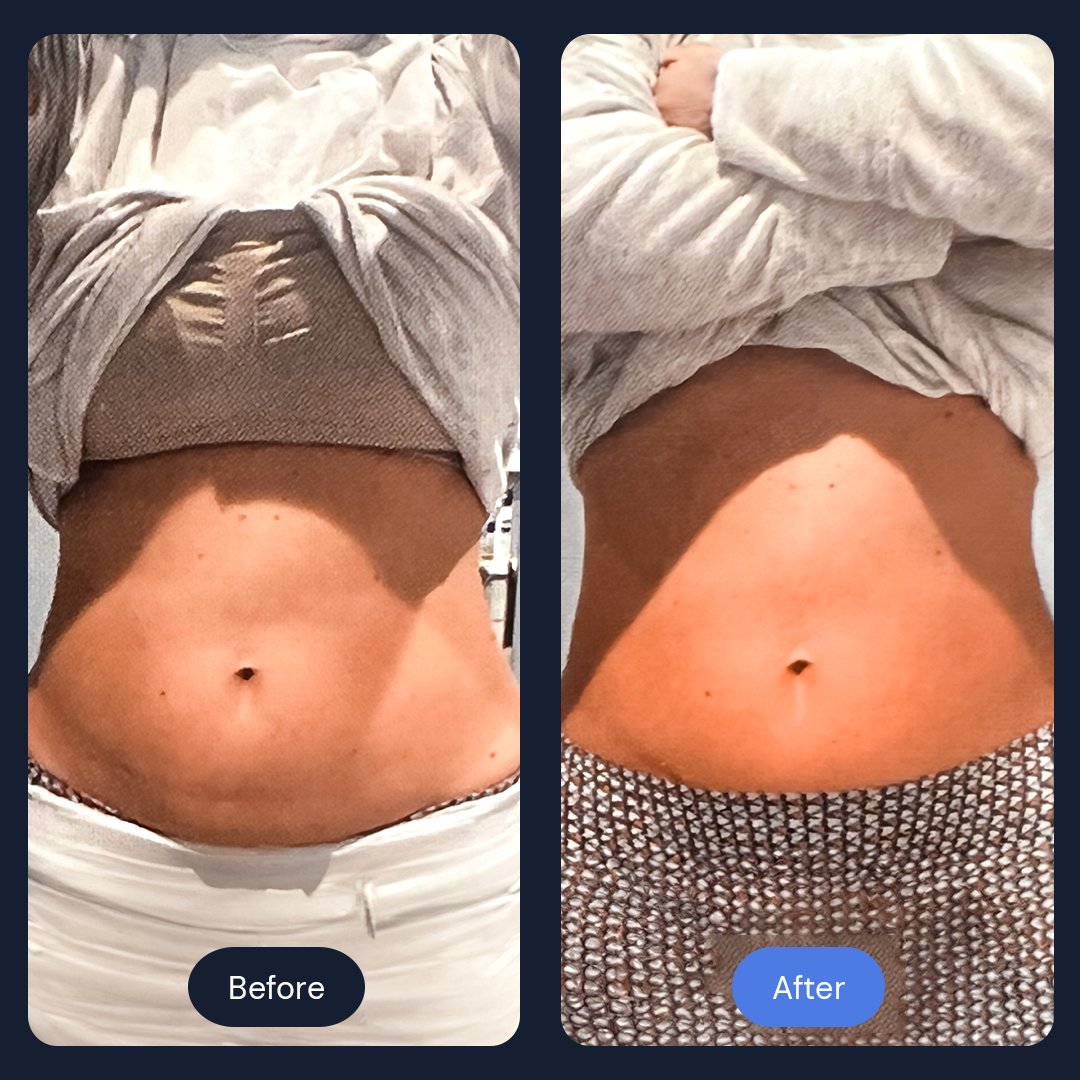 Before & After Gallery | Beauty Bar Wellness & Med Spa | Covington, GA