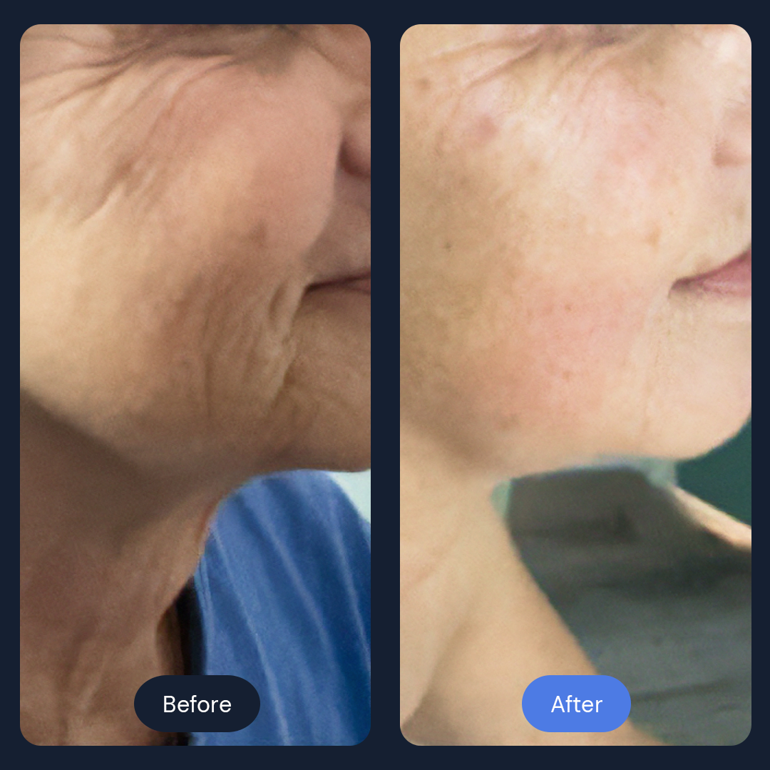 Before & After Gallery | Beauty Bar Wellness & Med Spa | Covington, GA