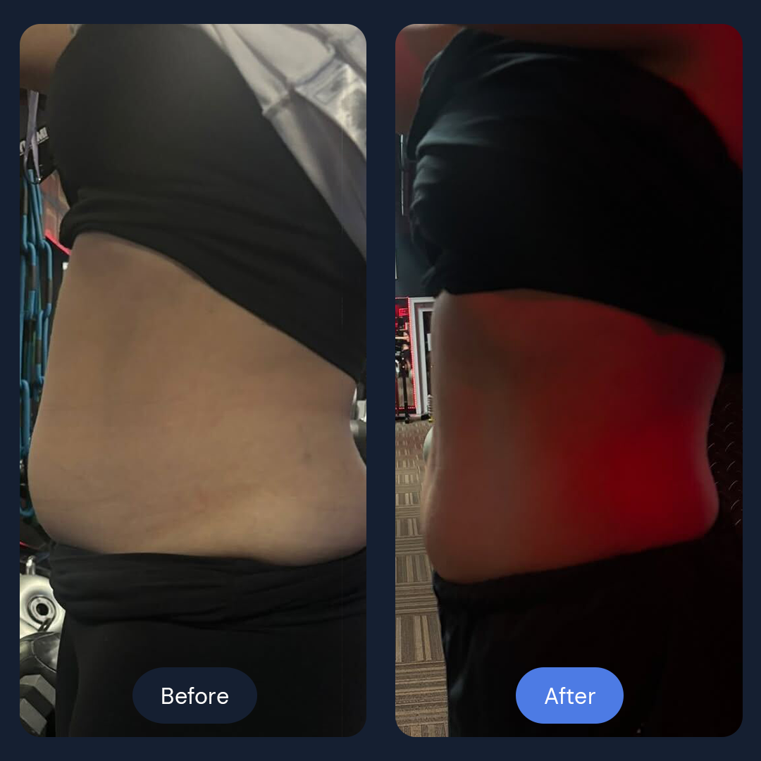 Before & After Gallery | Beauty Bar Wellness & Med Spa | Covington, GA