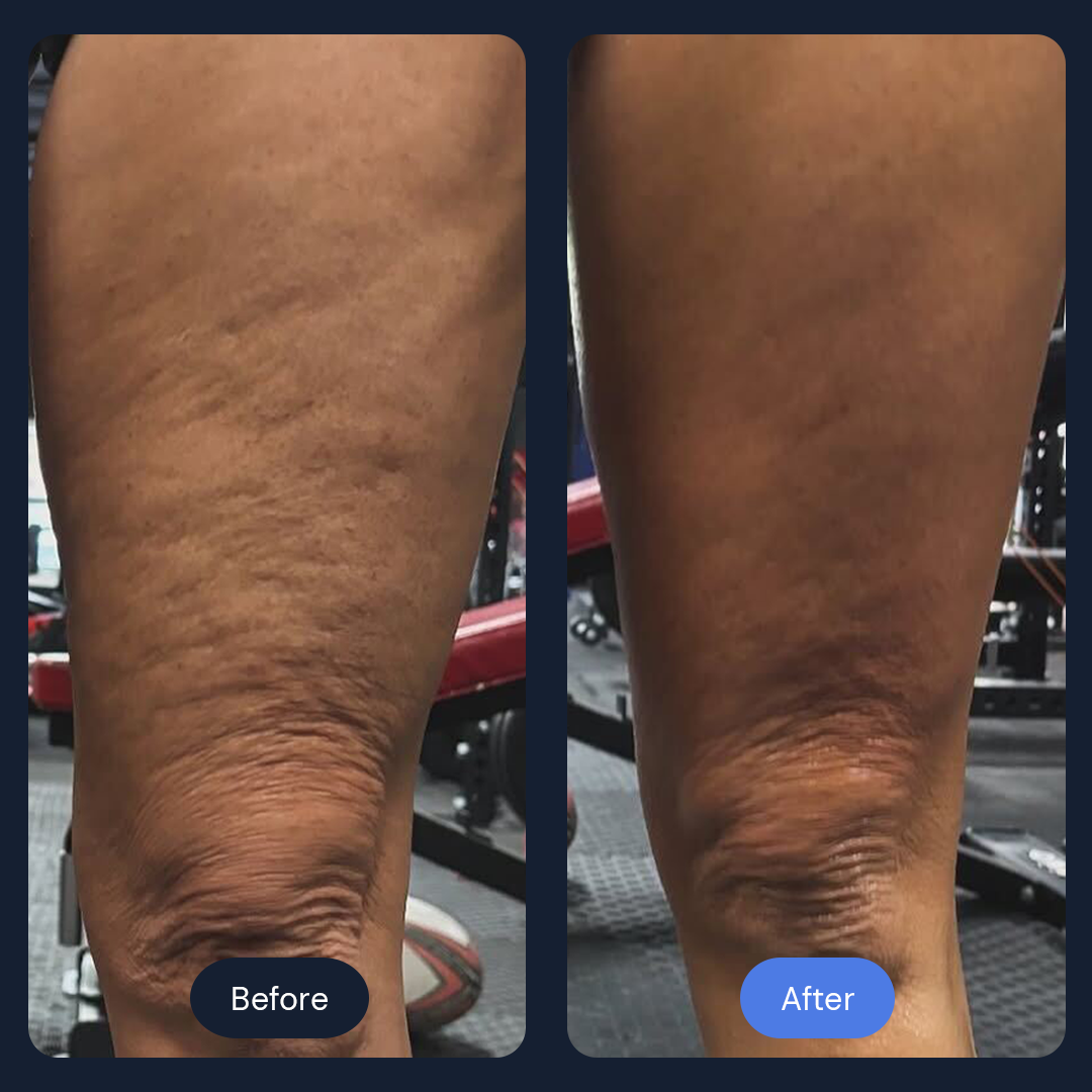 Before & After Gallery | Beauty Bar Wellness & Med Spa | Covington, GA