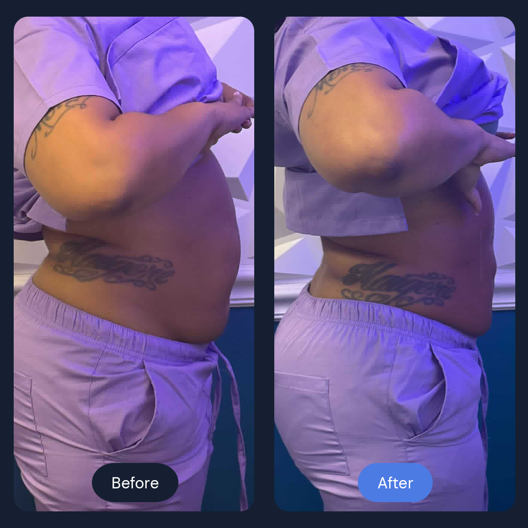 Before & After Gallery | Beauty Bar Wellness & Med Spa | Covington, GA