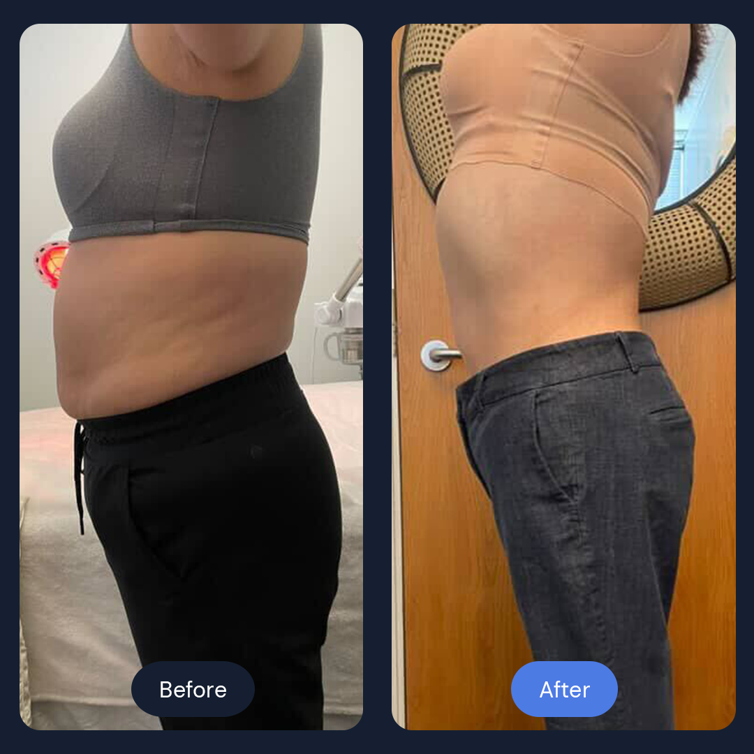 Before & After Gallery | Beauty Bar Wellness & Med Spa | Covington, GA