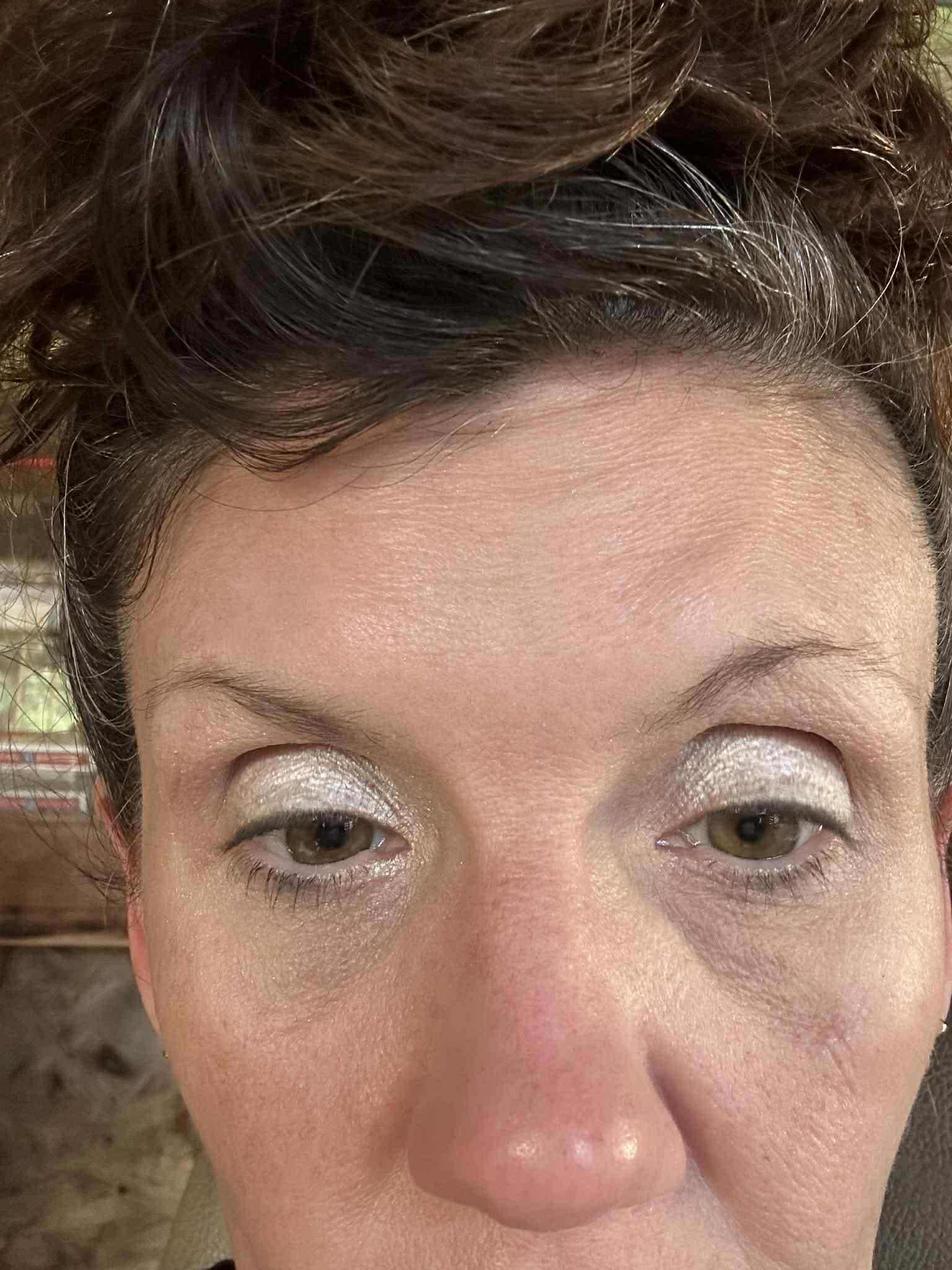 Injectables | Beauty Bar Med Spa | Covington, GA