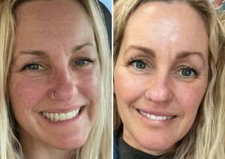 Beauty Membership | Beauty Bar Med Spa | Covington, GA