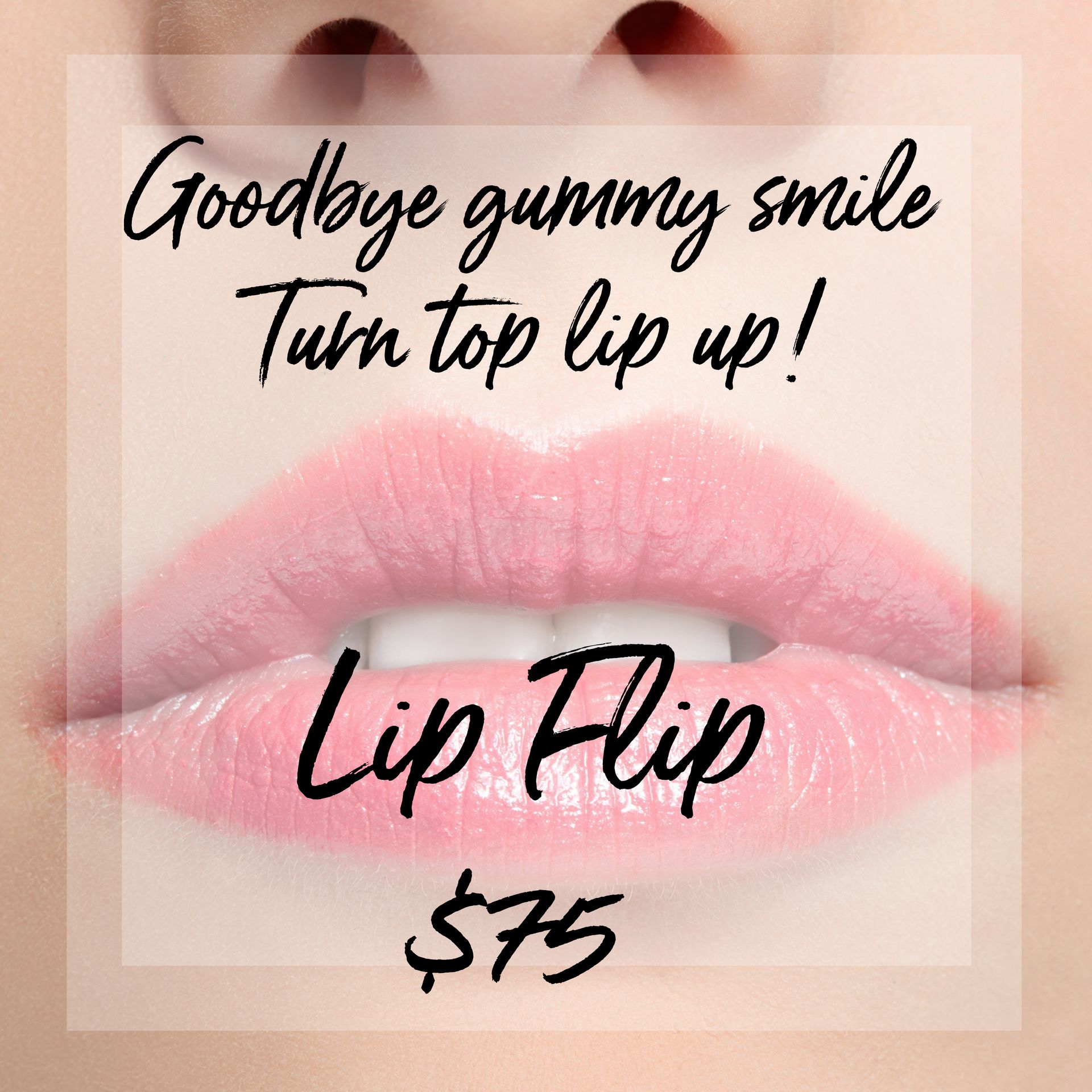 Injectables | Beauty Bar Med Spa | Covington, GA