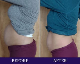 Peptides for Weight Loss | Beauty Bar Med Spa