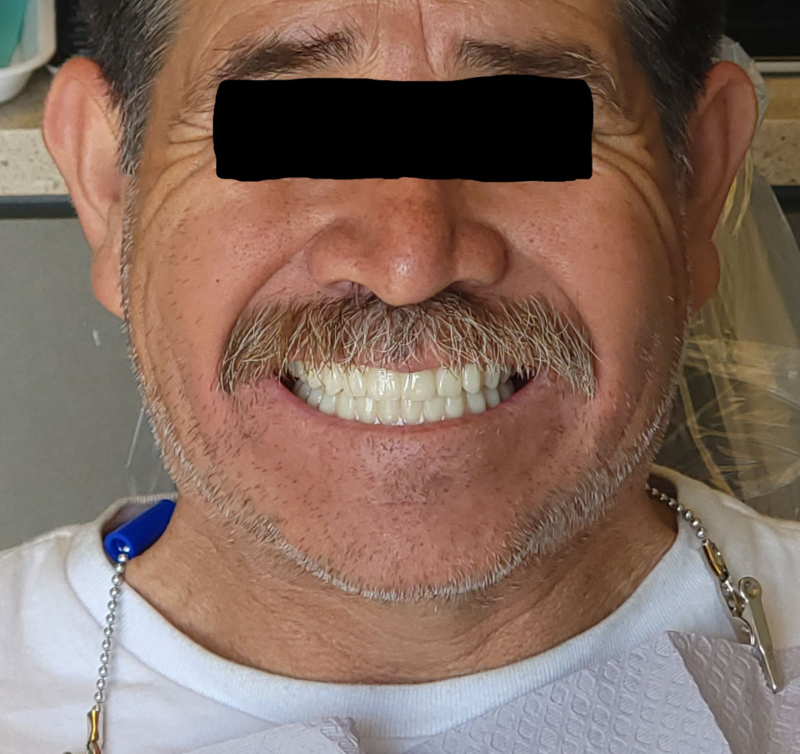 Close-up of a smiling man with a moustache, wearing a white shirt and blue lanyard.