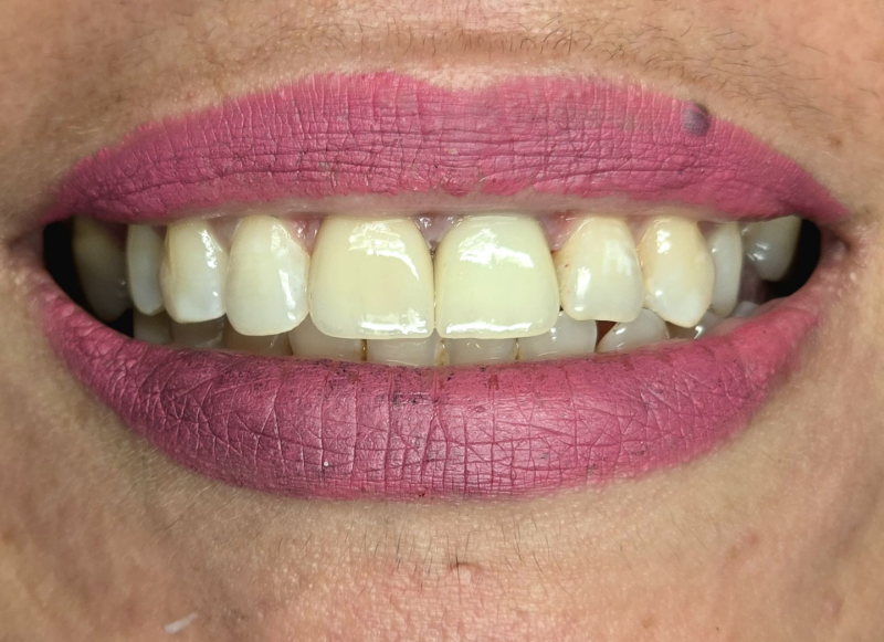 Close-up of smiling mouth with pink lipstick and visible teeth, showing small gap in the upper front teeth