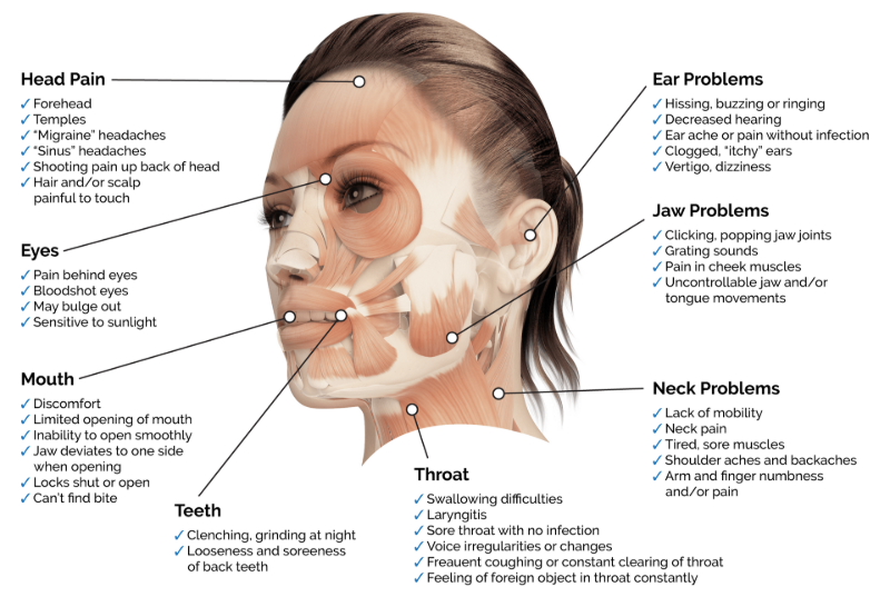 Diagram of facial pain symptoms, with labels on head, eyes, mouth, teeth, throat, ears, and neck.