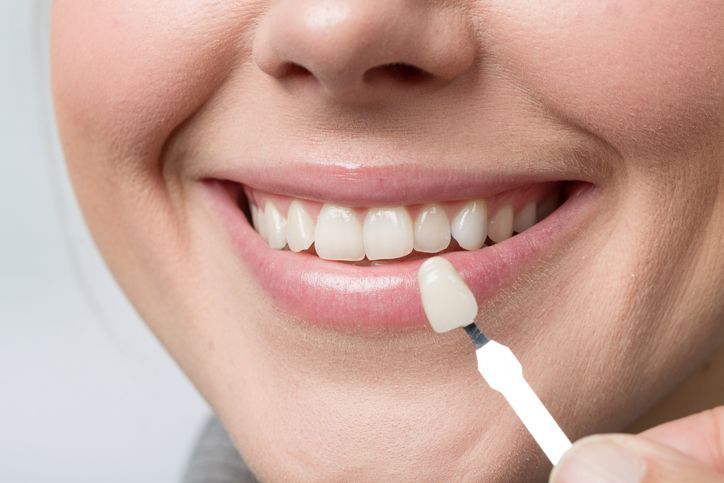 Close-up of a smiling mouth with a white applicator applying toothpaste to a front tooth