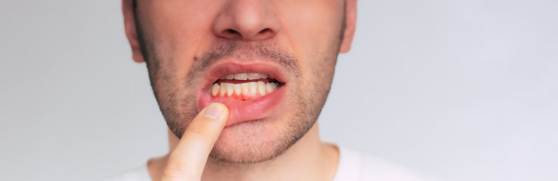 Close-up of a person biting a fingernail, showing teeth and lips against a light background