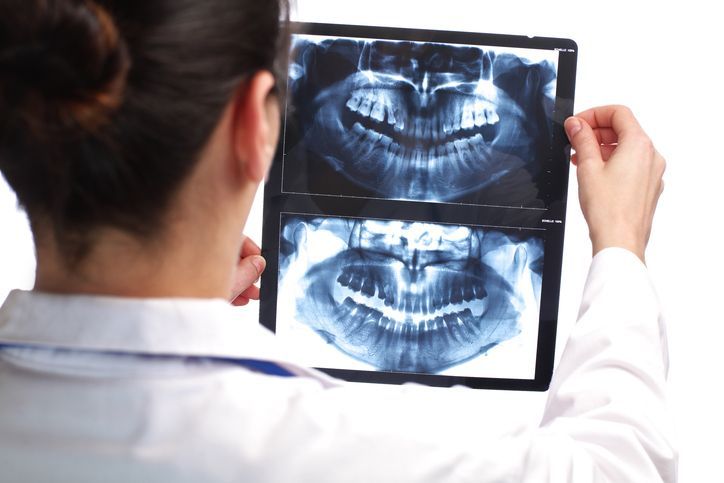 Dentist examining panoramic dental X-rays on a lightbox in a clinic