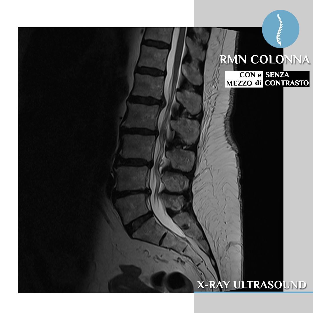 RMN colonna
